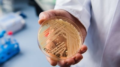 Washington State reports four cases of Candida auris (Getty Images)