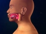 Gene editing offers hope to patients with inherited disorders: Study Gene editing offers hope to patients with inherited disorders: Study