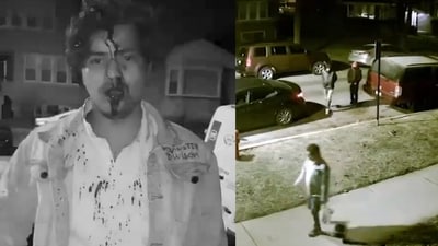 Syed Mazahir Ali, an Indian student pursuing a Master's Degree in the US, was left seriously injured after he was attacked by four men in Chicago (X, formerly Twitter/ Hate Detectors) Syed Mazahir Ali, an Indian student pursuing a Master's Degree in the US, was left seriously injured after he was attacked by four men in Chicago (X, formerly Twitter/ Hate Detectors)