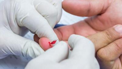 The study will help to clarify any doubts concerning the effectiveness of the BCG vaccine for preventing TB. (Representative Photo)