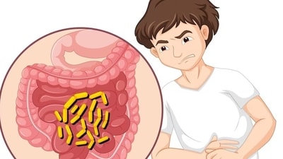 Worm infections can affect nutrient uptake in kids and cause problems like anaemia, malnourishment and impaired mental and physical development. (Freepik) Worm infections can affect nutrient uptake in kids and cause problems like anaemia, malnourishment and impaired mental and physical development. (Freepik)