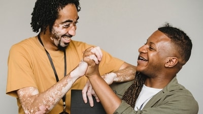 Here's how micro pigmentation can change the lives of those with vitiligo (Photo by Armin Rimoldi on Pexels) Here's how micro pigmentation can change the lives of those with vitiligo (Photo by Armin Rimoldi on Pexels)