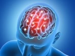 Actor Mithun Chakraborty was recently diagnosed with Ischemic Cerebrovascular Accident (Stroke)