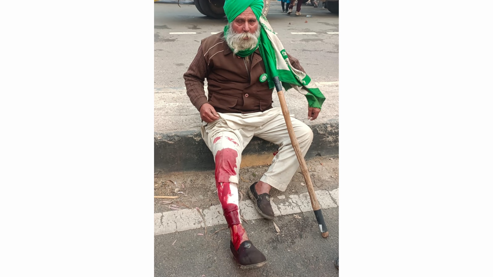An injured farmer at Khanauri border (HT Photo/Karam Prakash) An injured farmer at Khanauri border (HT Photo/Karam Prakash)