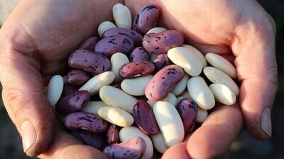 Legumes (Dals): Lentils, chickpeas, and other legumes are excellent sources of prebiotic fibres and provide a good dose of protein (Pixabay) Legumes (Dals): Lentils, chickpeas, and other legumes are excellent sources of prebiotic fibres and provide a good dose of protein (Pixabay)