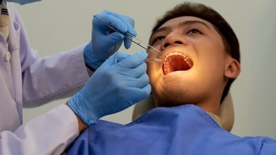 In addition to being the sixth most frequent cancer worldwide, mouth cancer is one of the most common among Indian men (Freepik) In addition to being the sixth most frequent cancer worldwide, mouth cancer is one of the most common among Indian men (Freepik)