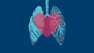UK scientists hail 'wonderful' new drug for mesothelioma, deadly asbestos-linked cancer (Image from Twitter/az_osteo) UK scientists hail 'wonderful' new drug for mesothelioma, deadly asbestos-linked cancer (Image from Twitter/az_osteo)