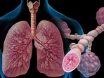 The study was done during the first wave of the pandemic in India on 207 Indians, and shows that the Indian subjects developed worse impairment in lung function compared to other published cohorts mostly with Caucasian subjects
