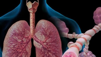 The study was done during the first wave of the pandemic in India on 207 Indians, and shows that the Indian subjects developed worse impairment in lung function compared to other published cohorts mostly with Caucasian subjects (Shutterstock) The study was done during the first wave of the pandemic in India on 207 Indians, and shows that the Indian subjects developed worse impairment in lung function compared to other published cohorts mostly with Caucasian subjects (Shutterstock)