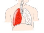 Air pollution linked to higher hospitalisations for heart, lung diseases: Study