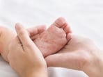 Measles typically begins with symptoms resembling those of a common cold, including fever, runny nose, cough, and red, watery eyes. (Shutterstock) Measles typically begins with symptoms resembling those of a common cold, including fever, runny nose, cough, and red, watery eyes. (Shutterstock)