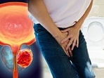 Warning signs of prostate cancer you should not ignore 