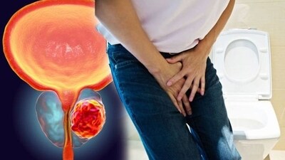 Warning signs of prostate cancer you should not ignore (Photo by Twitter/gyn_doctor) Warning signs of prostate cancer you should not ignore (Photo by Twitter/gyn_doctor)