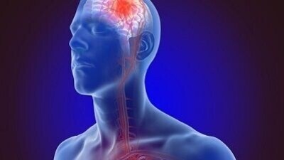 Zerodha's Nithin Kamath suffers ‘mild stroke’: How to recognise early signs, urgent actions for brain's heart attack (File Photo) Zerodha's Nithin Kamath suffers ‘mild stroke’: How to recognise early signs, urgent actions for brain's heart attack (File Photo)