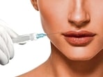 Social media trends and a shift in societal attitudes towards cosmetic procedures are getting more people to go in for dermal lip fillers (Shutterstock)