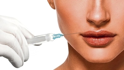 Social media trends and a shift in societal attitudes towards cosmetic procedures are getting more people to go in for dermal lip fillers (Shutterstock) Social media trends and a shift in societal attitudes towards cosmetic procedures are getting more people to go in for dermal lip fillers (Shutterstock)