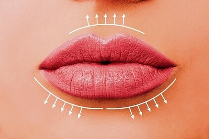 Discuss the aesthetic goal you have with the doctor and then choose your filler accordingly (Shutterstock) Discuss the aesthetic goal you have with the doctor and then choose your filler accordingly (Shutterstock)