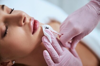 Speak to the doctor and follow the pre and post-treatment care tips to ensure healing after you get a lip filler (Shutterstock) Speak to the doctor and follow the pre and post-treatment care tips to ensure healing after you get a lip filler (Shutterstock)