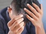 Amid the baldness problem that has been troubling the Chinese population, the smuggled hair from Hyderabad has been transported to China. (Representational Image) Amid the baldness problem that has been troubling the Chinese population, the smuggled hair from Hyderabad has been transported to China. (Representational Image)