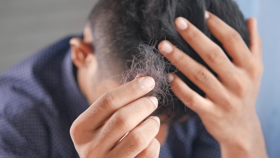 Amid the baldness problem that has been troubling the Chinese population, the smuggled hair from Hyderabad has been transported to China. (Representational Image) (Unsplash)