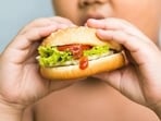 Obesity may affect the normal body metabolism and can lead to many health complications.