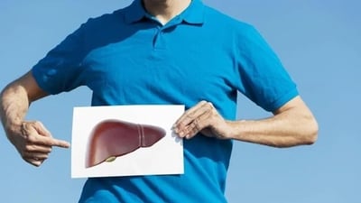 Fatty liver due to obesity (and not excessive alcohol consumption) is known as MASLD (metabolic dysfunction-associated steatotic liver disease). (Getty Images/iStockphoto) Fatty liver due to obesity (and not excessive alcohol consumption) is known as MASLD (metabolic dysfunction-associated steatotic liver disease). (Getty Images/iStockphoto)