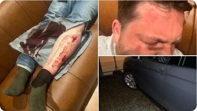Volkov with a bruise on his forehead, blood coming from a leg wound, and a vehicle with damage to the driver's door and window. (X/ @Kira_Yarmysh)