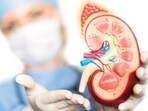 With obesity being a major cause of transplant exclusion, this collaborative program represents a path forward for patients who previously would be ineligible