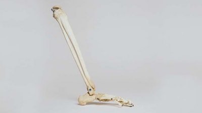 The increased fracture risk linked to previous falls was largely independent of bone mineral density, emphasising the standalone significance of falls as a risk factor. (Yahoo) The increased fracture risk linked to previous falls was largely independent of bone mineral density, emphasising the standalone significance of falls as a risk factor. (Yahoo)