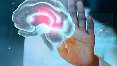According to the study, the most prevalent neurological disorders in 2021 were tension-type headaches. (Representative file photo) According to the study, the most prevalent neurological disorders in 2021 were tension-type headaches. (Representative file photo)
