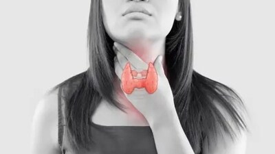 Thyroid problems commonly seen in women: Know its types, symptoms and treatment (Photo by Unsplash) Thyroid problems commonly seen in women: Know its types, symptoms and treatment (Photo by Unsplash)