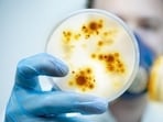 STAP-1 plays a key role in the activation of T cells, which are white blood cells that help the body defend itself against infections and preserve overall health. STAP-1 plays a key role in the activation of T cells, which are white blood cells that help the body defend itself against infections and preserve overall health.