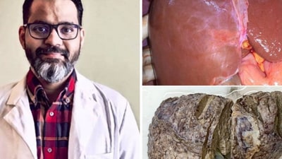Dr Cyriac Abby Philips aka 'The Liver Doc' routinely busts health-related misinformation. ( X/@theliverdr) Dr Cyriac Abby Philips aka 'The Liver Doc' routinely busts health-related misinformation. ( X/@theliverdr)