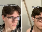 The image shows an individual who took part in the viral TikTok trend No-shampoo. The image shows an individual who took part in the viral TikTok trend No-shampoo.