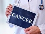 The mechanism of action of PARP inhibitors, which are specifically used for treating breast and ovarian cancer in individuals with the BRCA gene mutation, has been determined by a team from the University of Geneva (UNIGE) in cooperation with Basel-based FoRx Therapeutics. The mechanism of action of PARP inhibitors, which are specifically used for treating breast and ovarian cancer in individuals with the BRCA gene mutation, has been determined by a team from the University of Geneva (UNIGE) in cooperation with Basel-based FoRx Therapeutics.