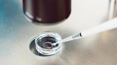 A lab technician puts fertilised egg under the microscope at a fertility laboratory. (Getty Images/iStockphoto) A lab technician puts fertilised egg under the microscope at a fertility laboratory. (Getty Images/iStockphoto)