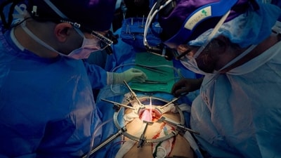 US doctors have transplanted world's first genetically-engineered pig kidney into a 62-year-old patient. US doctors have transplanted world's first genetically-engineered pig kidney into a 62-year-old patient.