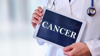 The mechanism of action of PARP inhibitors, which are specifically used for treating breast and ovarian cancer in individuals with the BRCA gene mutation, has been determined by a team from the University of Geneva (UNIGE) in cooperation with Basel-based FoRx Therapeutics. (Shutterstock) The mechanism of action of PARP inhibitors, which are specifically used for treating breast and ovarian cancer in individuals with the BRCA gene mutation, has been determined by a team from the University of Geneva (UNIGE) in cooperation with Basel-based FoRx Therapeutics. (Shutterstock)