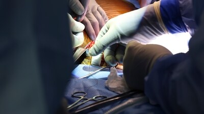 Surgeons perform the world’s first genetically modified pig kidney transplant into a living human at Massachusetts General Hospital, Saturday, March 16, 2024, in Boston, Mass. (Massachusetts General Hospital via AP) (AP) Surgeons perform the world’s first genetically modified pig kidney transplant into a living human at Massachusetts General Hospital, Saturday, March 16, 2024, in Boston, Mass. (Massachusetts General Hospital via AP) (AP)