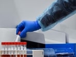 Some of the deadliest diseases to stalk humankind have come from pathogens that jumped from animals to people. The virus that causes AIDS, for example, crossed over from chimpanzees. And many experts believe the virus that caused the COVID-19 pandemic flowed from bats.(Reuters)