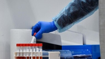 Some of the deadliest diseases to stalk humankind have come from pathogens that jumped from animals to people. The virus that causes AIDS, for example, crossed over from chimpanzees. And many experts believe the virus that caused the COVID-19 pandemic flowed from bats. (Reuters) Some of the deadliest diseases to stalk humankind have come from pathogens that jumped from animals to people. The virus that causes AIDS, for example, crossed over from chimpanzees. And many experts believe the virus that caused the COVID-19 pandemic flowed from bats. (Reuters)