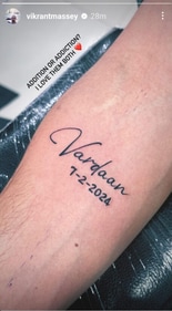 Vikrant shared a photo of his arm. Vikrant shared a photo of his arm.