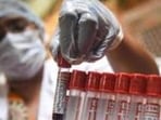 Maharashtra University of Health Sciences (MUHS) on Friday inaugurated its first genetic laboratory and cancer research centre in the city – MUHS Genehealth (REPRESENTATIVE IMAGE)