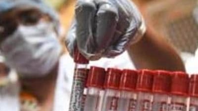 Maharashtra University of Health Sciences (MUHS) on Friday inaugurated its first genetic laboratory and cancer research centre in the city – MUHS Genehealth (REPRESENTATIVE IMAGE) Maharashtra University of Health Sciences (MUHS) on Friday inaugurated its first genetic laboratory and cancer research centre in the city – MUHS Genehealth (REPRESENTATIVE IMAGE)