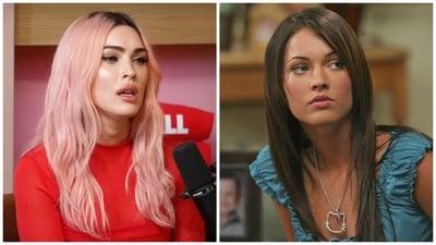 Megan Fox wishes to be 'transparent' about all the procedures she's got done.