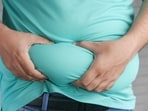 Obesity breakthrough: Study sheds light on genetic factors driving excess weight 