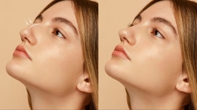 Want to achieve harmonious facial contours? Know all about non-surgical rhinoplasty or nose job (Image by Freepik) Want to achieve harmonious facial contours? Know all about non-surgical rhinoplasty or nose job (Image by Freepik)