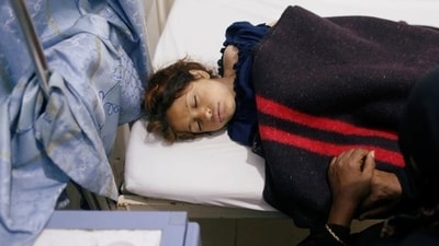 Two test positive for cholera after 47 students hospitalised in Bengaluru Two test positive for cholera after 47 students hospitalised in Bengaluru