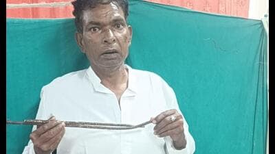 After recovery, the UP man poses with the iron rod that had pierced his heart. (SOURCED)