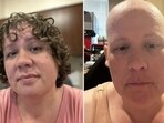 US woman was told she had terminal cancer and underwent 15 months of grueling chemotherapy, only to learn it was a misdiagnosis US woman was told she had terminal cancer and underwent 15 months of grueling chemotherapy, only to learn it was a misdiagnosis